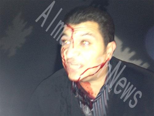 إسالة دماء شاب من الموالاة في جبل الحسين ( صور )